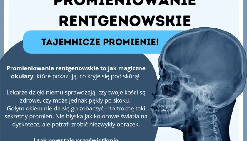 Promieniowanie rentgenowskie to magiczne okulary, które pokazują kości. Tajemnicze promienie tworzą niezwykłe prześwietlenia wnętrza.
