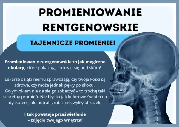 Promieniowanie rentgenowskie to magiczne okulary, które pokazują kości. Tajemnicze promienie tworzą niezwykłe prześwietlenia wnętrza.